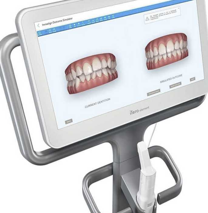 INvisalign-andover