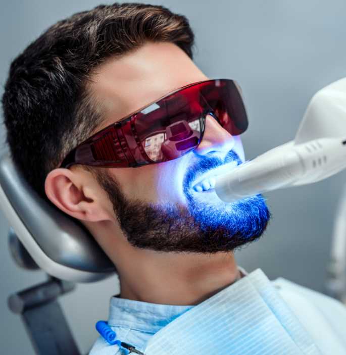 teeth-whitening-andover